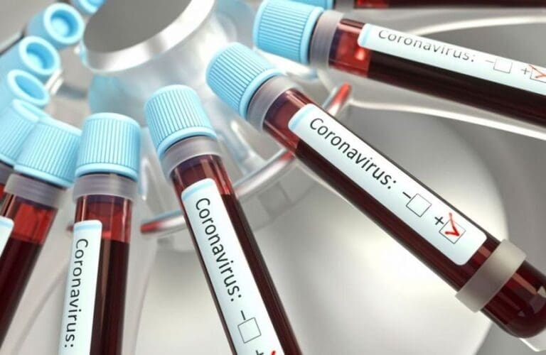 Ivaiporã mais cinco casos de covid-19 nesta terça 09