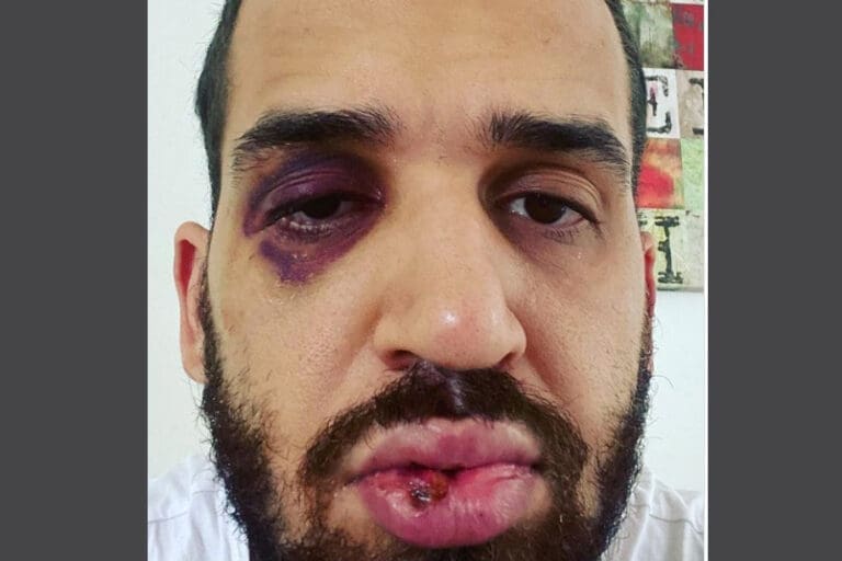 Médico é agredido após defender lockdown