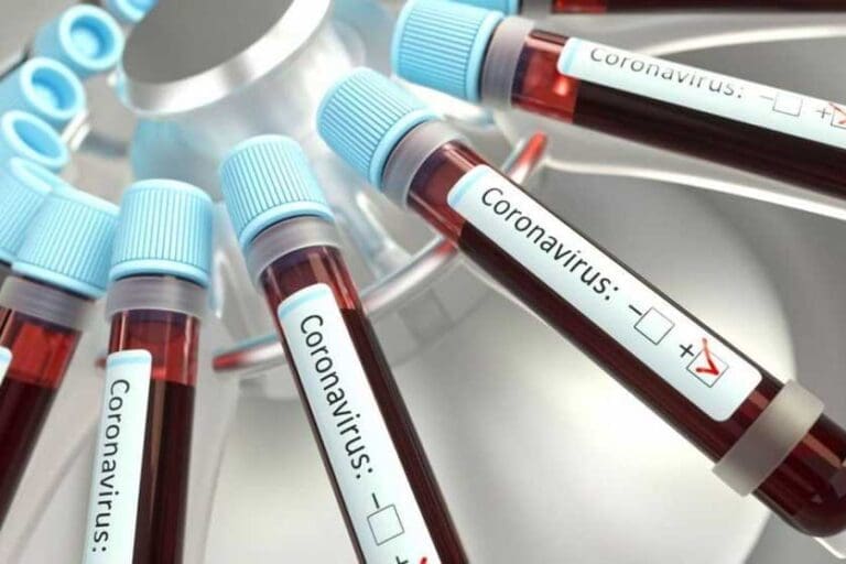 Mais 17 casos de Covid-19 confirmados em Ivaiporã