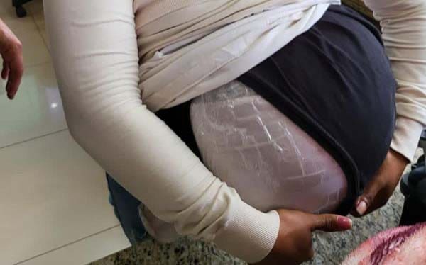 falsa grávida