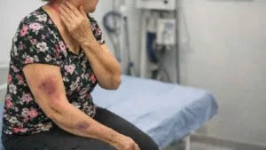 Mordora de Santa Mariana producrou ajuda no Posto de Saúde de Arirarana do Ivaí