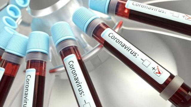 registro covid-19 não houve