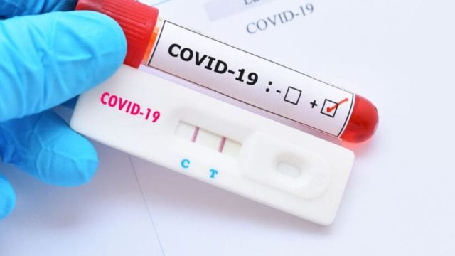 Covid-19 Foto: Imagem ilustrativa