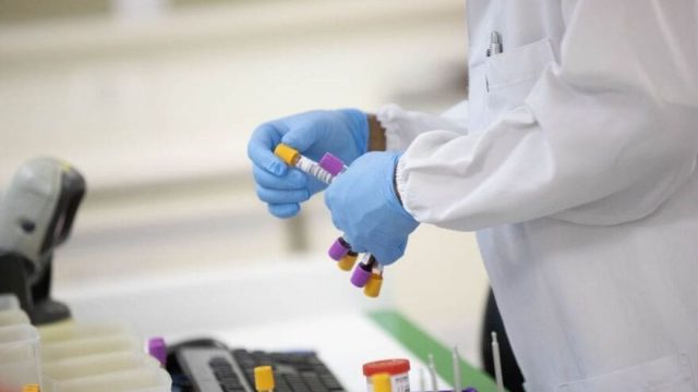 Ivaiporã registra 18 novos casos de Covid-19, sexta-feira (15/01)