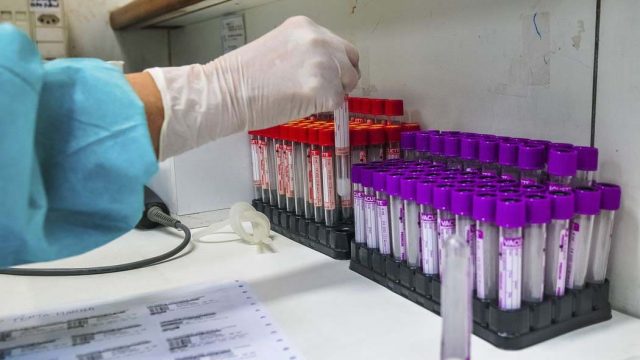 Covid-19 2501 Jardim Alegre mais casos