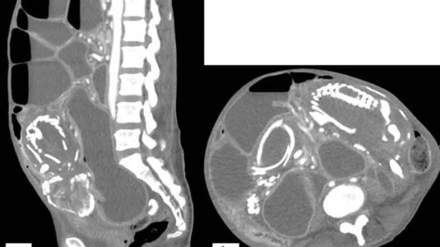 Reprodução/BMC Women's Health