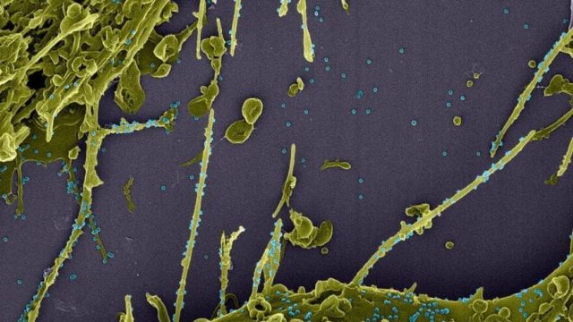 Estudo constata infecção simultânea por duas linhagens do coronavírus