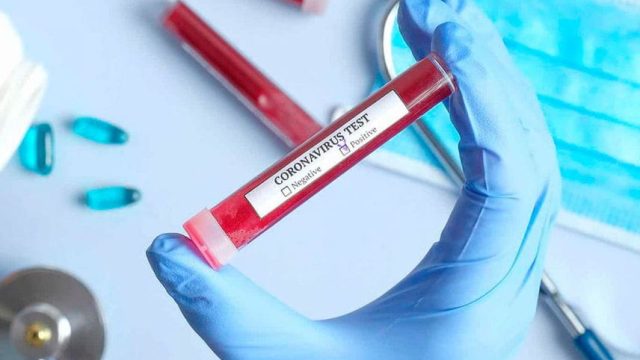 mais cinco casos de covid-19