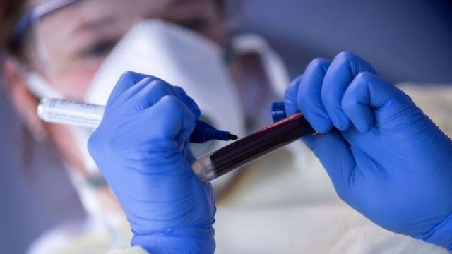 Jardim Alegre confirma casos de Covid-19