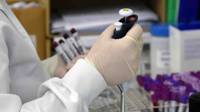 Paraná chega a 1 milhão de testes e amplia a capacidade