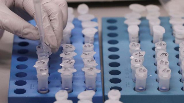 casos de Covid-19 confirmados