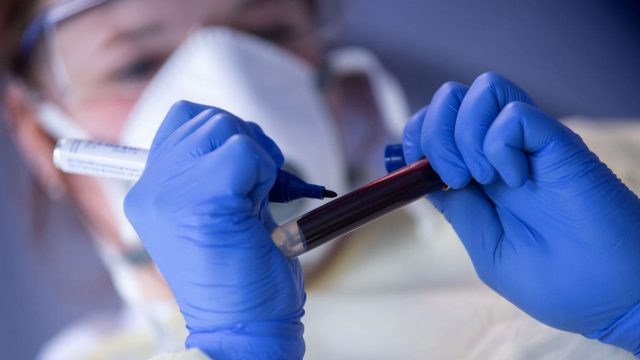 Saúde de Ivaiporã registra um caso de Covid-19 nesta quinta-feira (03)