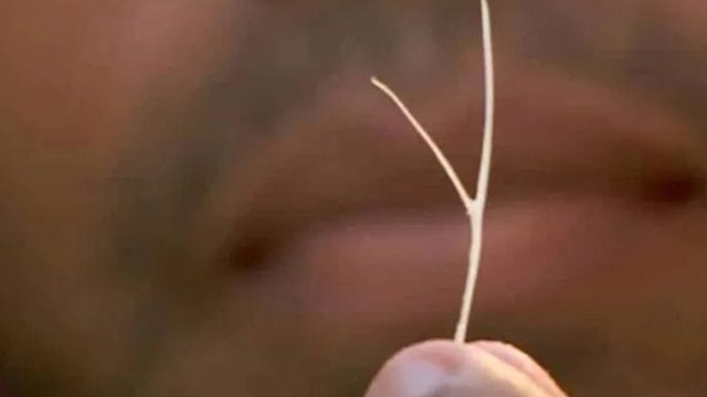 espinha-de-peixe_ Imagem meramente ilustrativa / Foto: Reprodução Vídeo/Bem EStar/Globopay